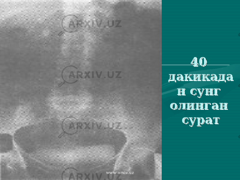 40 40 дакикададакикада н сунг н сунг олинган олинган суратсурат www.arxiv.uz 