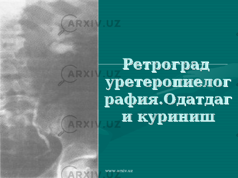 Ретроград Ретроград уретеропиелогуретеропиелог рафия.Одатдаграфия.Одатдаг и куриниши куриниш www.arxiv.uz 