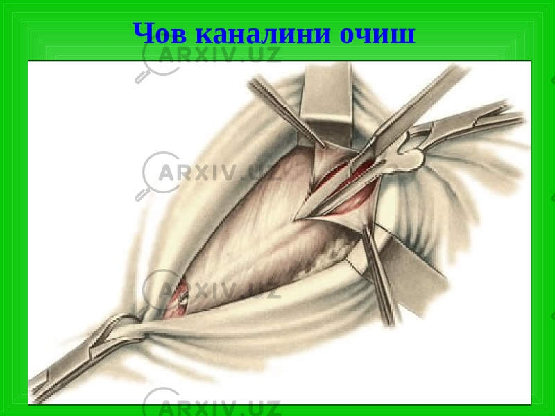 Чов каналини очиш 