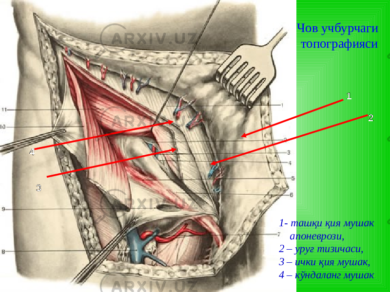 4 1 2 3 1- ташқи қи я му шак апоневрози, 2 – уруғ тизичаси, 3 – ички қ ия м у шак , 4 – кўндаланг м у шакЧов учбурчаги т опография си 