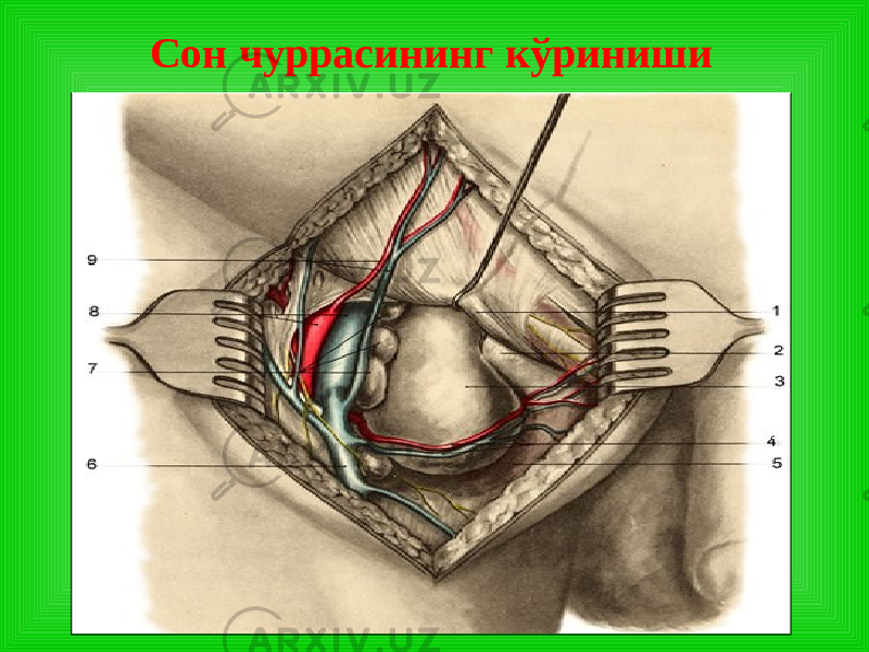 Сон чуррасининг кўриниши 