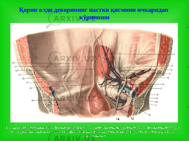 Қорин олди деворининг пастки қисмини ичкаридан кўриниши 1 — m. rectus abdominis; 2 — lig. interfoveolare; 3 — anulus inguinalis profundus; 4 — lig. inguinale; 5 — a. et v. epigastrica inferior; 8 — a. et v. iliaca externa; 10 — n. obturatorius; 13 — ductus deferens; 14 — vesica urinaria; 