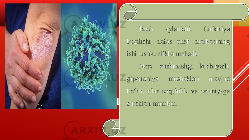 ALKALOZNING TURLARI Bosh aylanishi, funktsiya buzilishi, nafas olish markazining ishi tushkunlikka tushadi. Nerv etishmasligi kuchayadi, gipertoniya mushaklari mavjud bo&#39;lib, ular soqchilik va tetaniyaga o&#39;tishlari mumkin. 