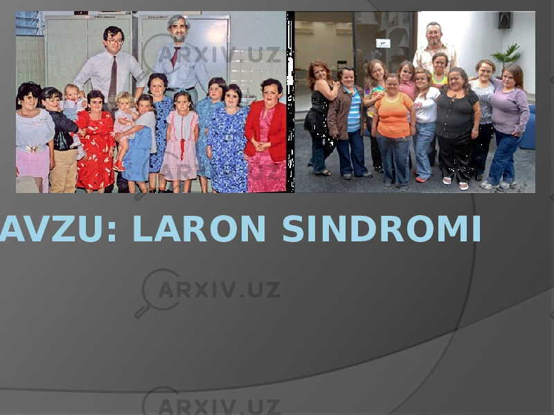  MAVZU: LARON SINDROMI 