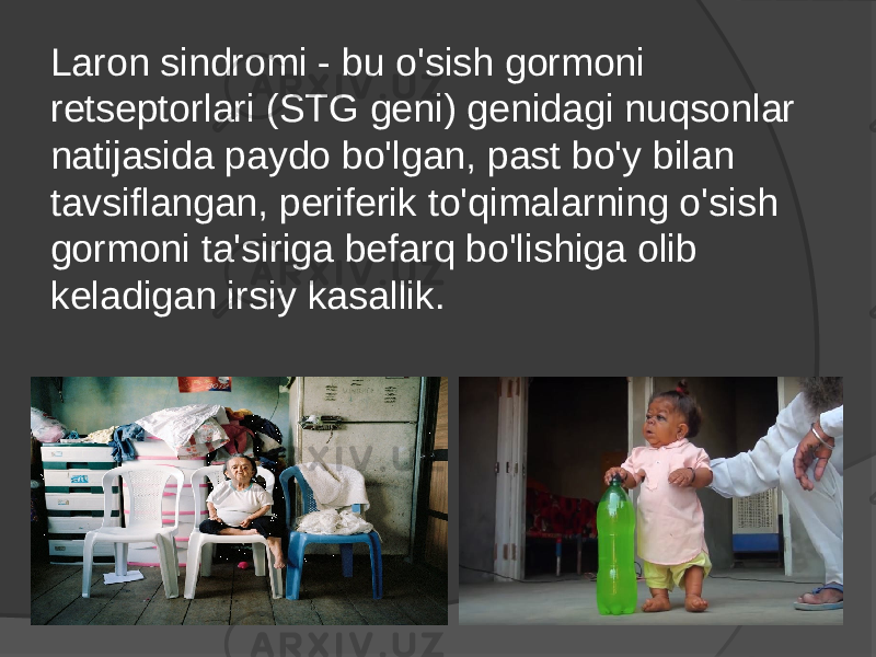 Laron sindromi - bu o&#39;sish gormoni retseptorlari (STG geni) genidagi nuqsonlar natijasida paydo bo&#39;lgan, past bo&#39;y bilan tavsiflangan, periferik to&#39;qimalarning o&#39;sish gormoni ta&#39;siriga befarq bo&#39;lishiga olib keladigan irsiy kasallik. 