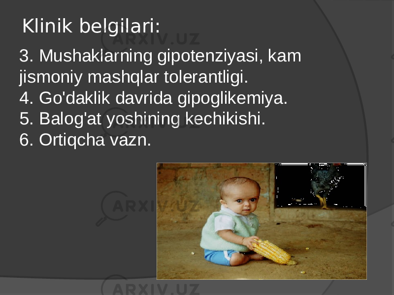 Klinik belgilari: 3. Mushaklarning gipotenziyasi, kam jismoniy mashqlar tolerantligi. 4. Go&#39;daklik davrida gipoglikemiya. 5. Balog&#39;at yoshining kechikishi. 6. Ortiqcha vazn. 