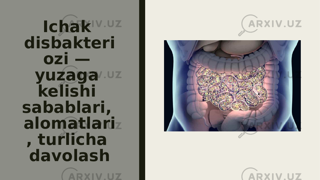 Ichak disbakteri ozi — yuzaga kelishi sabablari, alomatlari , turlicha davolash 