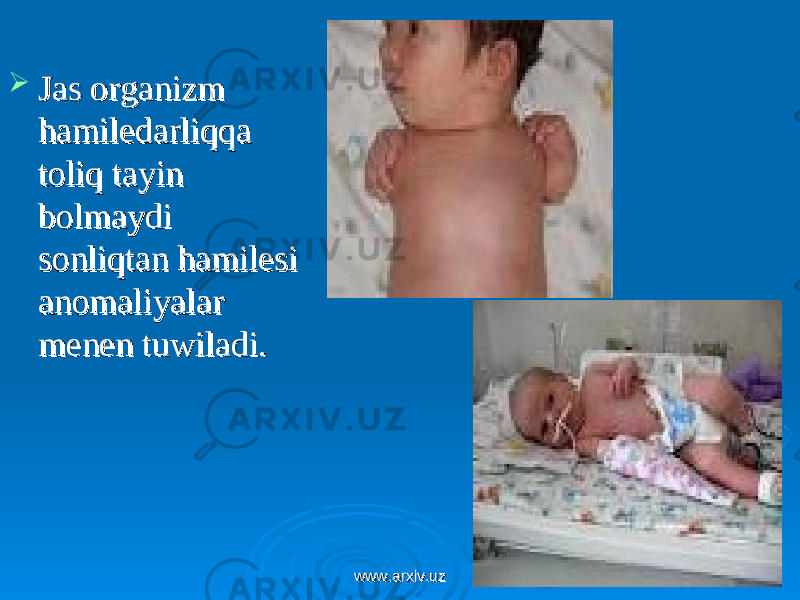  Jas organizm Jas organizm hamiledarliqqa hamiledarliqqa toliq tayin toliq tayin bolmaydi bolmaydi sonliqtan hamilesi sonliqtan hamilesi anomaliyalar anomaliyalar menen tuwiladi.menen tuwiladi. www.arxiv.uzwww.arxiv.uz 