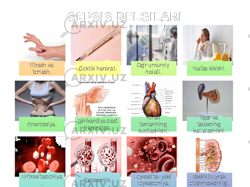 SEPSIS BELGILARI Titrash va terlash. Gektik harorat. Ogir umumiy holati. Nafas kisishi. Anoreksiya. Tahikardiya past haroratda. Yurak tonlarining sustlashishi. Jigar va talokning kattalashishi. Eritrositopeniya . Kamkonlik. Leykocitoz yoki leykopeniya. Toksik buyrak etishmovchiligi. 