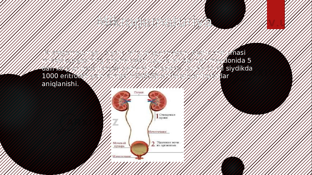  Mikrogematuriya Mikrogematuriya - siydik rangi o’zgarmagan, siydik cho’kmasi mikroskopiyasining chamalovchi usul bilan (ko’rish maydonida 5 dan ko’p eritrotsitlar) va samarali miqdoriy usulda (1 ml siydikda 1000 eritrotsit yoki kuniga 1000000 eritrotsit) eritrotsitlar aniqlanishi. 