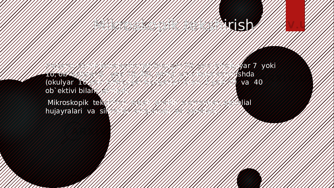  Mikroskopik tekshirish Preparat kichik kattalashtarish (okulyar 10 yoki binokulyar 7 yoki 10, ob`ektivlar 8 yoki 10, 20), so’ng yirik kattalashtirishda (okulyar 10 yoki binokulyar okulyarlari bilan, 7 yoki 10 va 40 ob`ektivi bilan) ko’riladi. Mikroskopik tekshirish orqali shaklli elementlar, epitelial hujayralari va silindrlar aniqlanadi va sanaladi. 