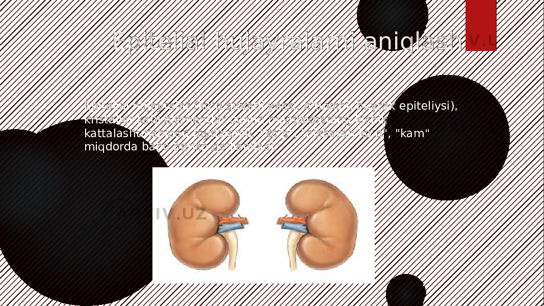  Epitelial hujayralarni aniqlash Epitelial hujayralar (ko’p qavatli yassi, o’tuvchi, buyrak epiteliysi), kristallar kabi elementlar uchun mikroskopning kichik kattalashtirishidan foydalanib, &#34;ko’p&#34;, &#34;nisbatan ko’p&#34;, &#34;kam&#34; miqdorda baho berish qo’llaniladi. 