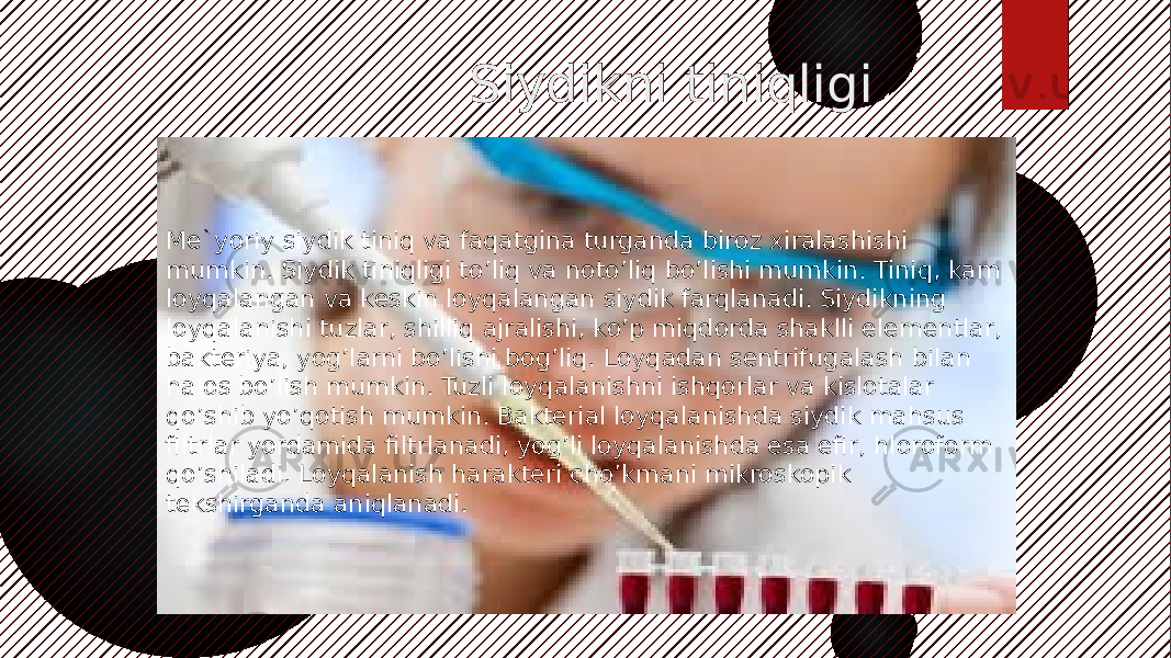  Siydikni tiniqligi Me`yoriy siydik tiniq va faqatgina turganda biroz xiralashishi mumkin. Siydik tiniqligi to’liq va noto’liq bo’lishi mumkin. Tiniq, kam loyqalangan va keskin loyqalangan siydik farqlanadi. Siydikning loyqalanishi tuzlar, shilliq ajralishi, ko’p miqdorda shaklli elementlar, bakteriya, yog’larni bo’lishi bog’liq. Loyqadan sentrifugalash bilan halos bo’lish mumkin. Tuzli loyqalanishni ishqorlar va kislotalar qo’shib yo’qotish mumkin. Bakterial loyqalanishda siydik mahsus filtrlar yordamida filtrlanadi, yog’li loyqalanishda esa efir, hloroform qo’shiladi. Loyqalanish harakteri cho’kmani mikroskopik tekshirganda aniqlanadi. 