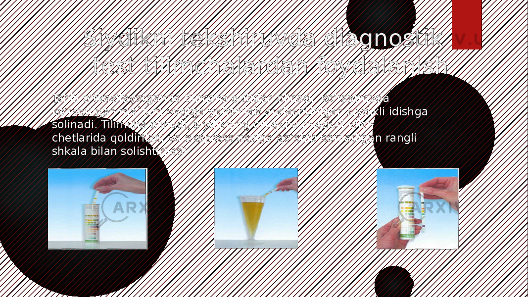 Siydikni tekshiruvda diagnostik test tilimchalardan foydalanish Tahlil o’tkazilayotganda tilimcha qutidan olinadi, ko’rsatmada ko’rsatilgan ma`lum vaqtga yahshilab aralashtirilgan siydikli idishga solinadi. Tilimcha olinadi, siydikning ortiqcha miqdori idish chetlarida qoldiriladi va ekspress usulga qo’shib beriladigan rangli shkala bilan solishtiriladi 